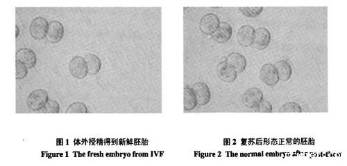 液氮运输罐短期储存胚胎的可行性研究的结果